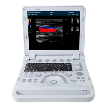 Digitalni ultrazvučni sustav CONTEC CMS1700A s ručni boji доплерографией osobe